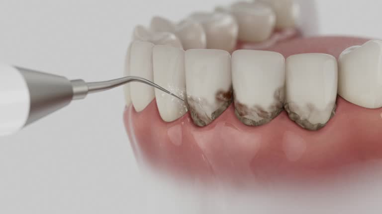 Reliable Dental contractor in Millersburg, OH by Dentist Open Now
